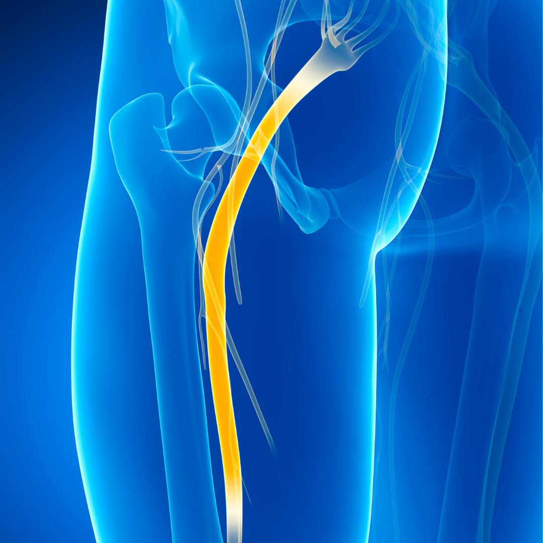 A man experiencing lower sciatic nerve pain as pain all the way down the leg